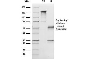 SDS-PAGE Analysis Purified p57 Mouse Monoclonal Antibody (57P06). (CDKN1C antibody)