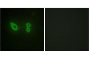Immunofluorescence analysis of HeLa cells, using Actinin alpha-2/3 Antibody.