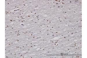 Immunostaining (ISt) image for anti-Cell Cycle Checkpoint Protein RAD1 (RAD1) (AA 1-90) antibody (ABIN562541)