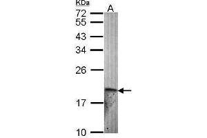 WB Image Sample (30 ug of whole cell lysate) A: Hela 12% SDS PAGE antibody diluted at 1:1000 (Endothelin 2 antibody)