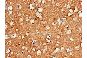 Immunohistochemistry of paraffin-embedded human brain tissue using ABIN7155209 at dilution of 1:100 (HMGB2 antibody  (AA 43-185))