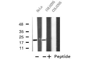 Western blot analysis of extracts from HeLa/COLO205 cells, using MRPL49 antibody. (MRPL49 antibody  (Internal Region))