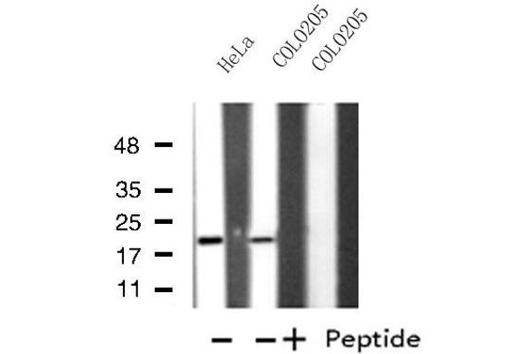 MRPL49 antibody  (Internal Region)