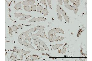 Immunoperoxidase of monoclonal antibody to HCAP-G on formalin-fixed paraffin-embedded human skeletal muscle. (NCAPG antibody  (AA 336-435))