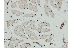 Immunoperoxidase of monoclonal antibody to HCAP-G on formalin-fixed paraffin-embedded human skeletal muscle. (NCAPG antibody  (AA 336-435))