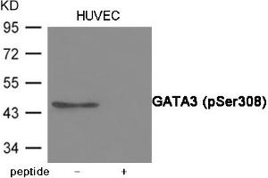 Western blot analysis of extracts from HUVEC cells using GATA3 (Phospho-Ser308) Antibody. (GATA3 antibody  (pSer308))