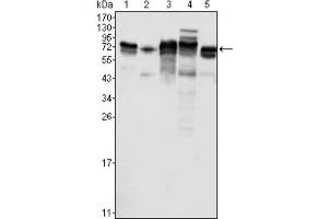 Western Blotting (WB) image for anti-Metadherin (MTDH) antibody (ABIN1844342) (MTDH antibody)