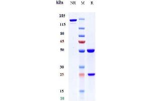 Anti-Complement C2 Reference Antibody (ARGX-117) on SDS-PAGE under reducing (R) condition. (Recombinant Complement C2 antibody)