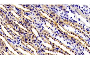 Immunohistochemistry (IHC) image for anti-Interleukin 6 Signal Transducer (Gp130, Oncostatin M Receptor) (IL6ST) (AA 26-323) antibody (ABIN7430558)