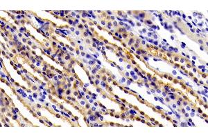 Detection of gp130 in Rat Kidney Tissue using Polyclonal Antibody to Glycoprotein 130 (gp130) (CD130/gp130 antibody  (AA 26-323))