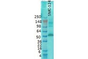 western rat membrane 1 in 1000 CaMKII. (CAMKII gamma antibody)