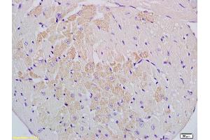 Formalin-fixed and paraffin embedded mouse heart labeled with Anti-Cyp2-j3 Polyclonal Antibody, Unconjugated (ABIN872965) at 1:200 followed by conjugation to the secondary antibody and DAB staining (Cytochrome P450, Family 2, Subfamily J, Polypeptide 3 (CYP2J3) (AA 401-502) antibody)