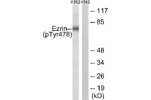 Lane 1: The extracts from K562 cells treated with Na3VO4 (0. (Ezrin antibody  (pTyr478))