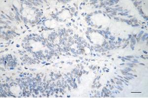 anti-Suppression of Tumorigenicity 13 (ST13) antibody