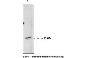 Image no. 1 for anti-Hematopoietic Prostaglandin D Synthase (HPGDS) antibody (ABIN2450695) (HPGDS antibody)