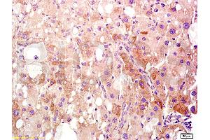 Immunohistochemistry (IHC) image for anti-High Mobility Group Box 1 (HMGB1) (AA 75-170) antibody (ABIN671616)