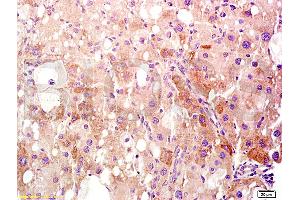 Formalin-fixed and paraffin embedded rat liver tissue labeled Anti-HMGB1 Polyclonal Antibody, Unconjugated (ABIN671616) at 1:400, followed by conjugation to the secondary antibody and DAB staining (HMGB1 antibody  (AA 75-170))
