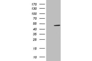 Western Blotting (WB) image for anti-alpha-Methylacyl-CoA Racemase (AMACR) antibody (ABIN2716026)