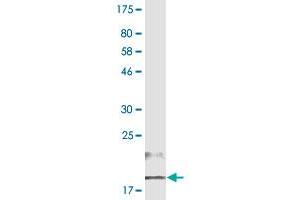 Western Blot detection against Immunogen (16.