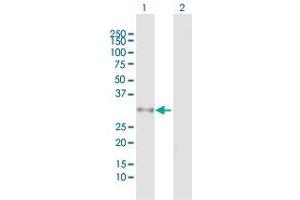 Western Blot analysis of DHRS9 expression in transfected 293T cell line by DHRS9 MaxPab polyclonal antibody.