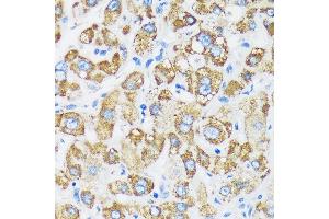 Immunohistochemistry of paraffin-embedded Human liver using GTPBP8 Rabbit pAb (ABIN7267527) at dilution of 1:100 (40x lens). (GTPBP8 antibody  (AA 1-170))