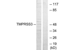 Western Blotting (WB) image for anti-Transmembrane Protease, Serine 3 (TMPRSS3) (C-Term) antibody (ABIN1849484) (TMPRSS3 antibody  (C-Term))