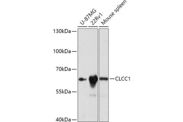 CLCC1 Antikörper  (AA 302-501)