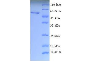 SDS-PAGE (SDS) image for Lecithin-Cholesterol Acyltransferase (LCAT) (AA 25-433), (partial) protein (His tag) (ABIN4976501) (LCAT Protein (AA 25-433, partial) (His tag))