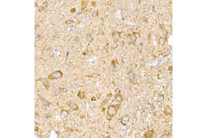Immunohistochemistry of paraffin-embedded mouse spinal cord using NgR3 Rabbit mAb (ABIN7269932) at dilution of 1:50 (40x lens). (RTN4RL1 antibody)