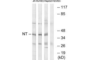 Western blot analysis of extracts from Jurkat cells, HUVEC cells and HepG2 cells, using NT antibody. (NT (C-Term) antibody)