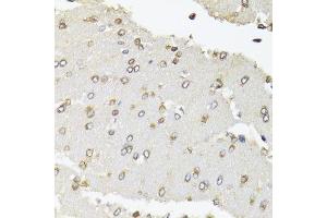 Immunohistochemistry of paraffin-embedded rat brain using POLR2B antibody. (POLR2B antibody  (AA 1-260))