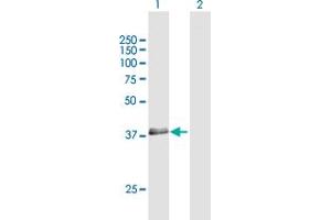 Western Blot analysis of RNF34 expression in transfected 293T cell line by RNF34 MaxPab polyclonal antibody. (RNF34 antibody  (AA 1-373))