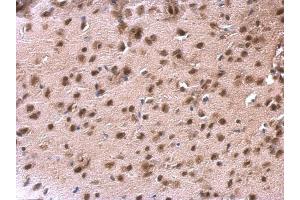IHC-P Image DDX1 antibody [N3C2], Internal detects DDX1 protein at nucleus on mouse fore brain by immunohistochemical analysis. (DDX1 antibody  (Internal Region))