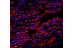 Immunofluorescence of paraffin embedded rat lung using C1orf173 (ABIN7074073) at dilution of 1: 650 (350x lens) (Glutamate-Rich Protein 3 (ERICH3) antibody)
