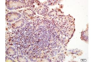Formalin-fixed and paraffin embedded rat brain labeled with Rabbit Anti Phospho-Histone H3 (Ser10) Polyclonal Antibody, Unconjugated (ABIN742553) at 1:200 followed by conjugation to the secondary antibody and DAB staining