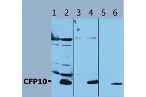 Western Blotting (Mycobacterium Tuberculosis Antigen CFP10 (Rv3874) antibody)