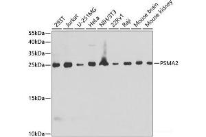 Western blot analysis of extracts of various cell lines using PSMA2 Polyclonal Antibody at dilution of 1:1000.