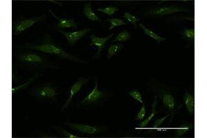 Immunofluorescence of purified MaxPab antibody to GOLGA1 on HeLa cell.