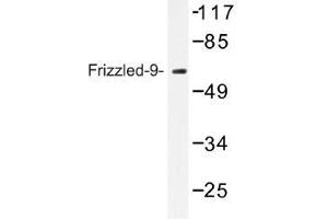 Image no. 1 for anti-Frizzled Family Receptor 9 (FZD9) antibody (ABIN317735)