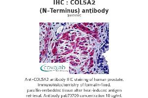 Image no. 1 for anti-Collagen, Type V, alpha 2 (COL5A2) antibody (ABIN1733201) (COL5A2 antibody)