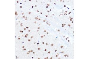Immunohistochemistry of paraffin-embedded mouse brain using SETD5 Rabbit pAb (ABIN6132960, ABIN6147644, ABIN6147646 and ABIN6223140) at dilution of 1:100 (40x lens). (SETD5 antibody  (AA 520-740))