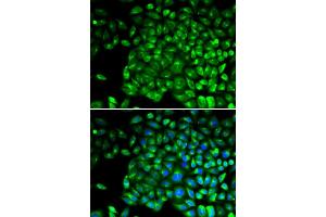 Immunofluorescence analysis of U2OS cells using TNFR2/TNFR2/TNFRSF1B antibody (ABIN1683061, ABIN3015125, ABIN3015126 and ABIN6213832). (TNFRSF1B antibody  (AA 30-250))