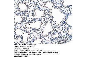 ARP40336 Paraffin Embedded Tissue: Human Lung Cellular Data: Alveolar cells Antibody Concentration: 4. (KIAA0020 antibody  (N-Term))