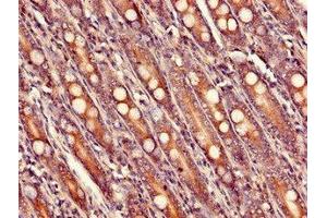Immunohistochemistry of paraffin-embedded human small intestine tissue using ABIN7175150 at dilution of 1:100 (USHBP1 antibody  (AA 1-260))