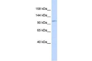 Western Blot showing AVIL antibody used at a concentration of 1-2 ug/ml to detect its target protein. (Advillin antibody  (Middle Region))
