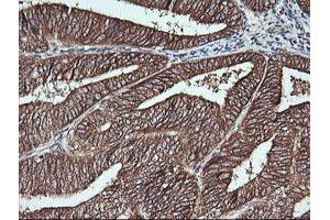 Image no. 2 for anti-Musashi Homolog 2 (MSI2) antibody (ABIN1499578) (MSI2 antibody)