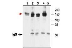 Immunoprecipitation of KV11. (KCNH2 antibody  (Intracellular))