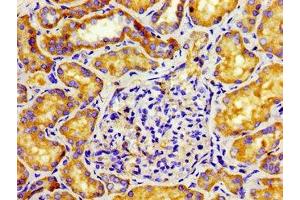 Immunohistochemistry of paraffin-embedded human kidney tissue using ABIN7146085 at dilution of 1: 100 (CD27 antibody  (AA 229-312))