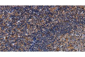 Immunohistochemistry of paraffin-embedded Human tonsil using LIMS1 Polyclonal Antibody at dilution of 1:40 (LIMS1 antibody)