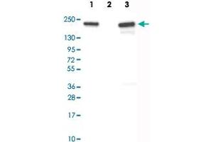 Western Blot analysis of Lane 1: over-expression lysate (co-expressed with a C-terminal myc-DDK tag in mammalian HEK293T cells), Lane 2: negative control (vector only transfected HEK293T cell lysate) and Lane 3: U-251 cell lysate with ATAD2 monoclonal antibody, clone CL0182 . (ATAD2 antibody)